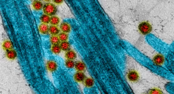 2020, un anno importante per la Fondazione Air Liquide